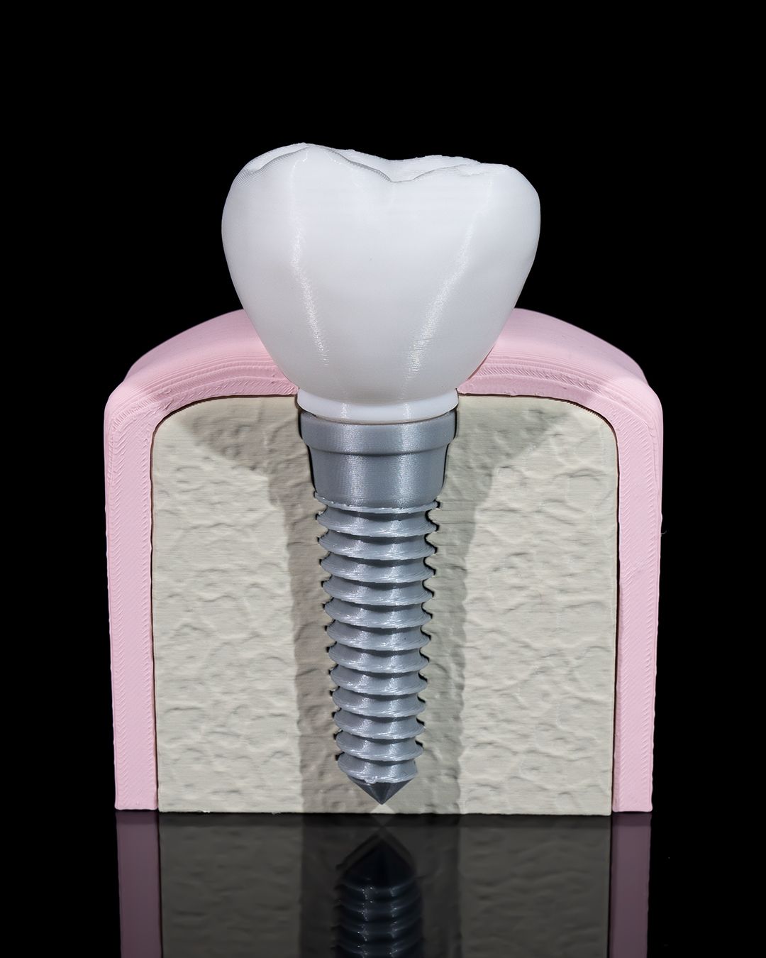 Healthy Premolar Tooth - 3D Printed Dental Replica