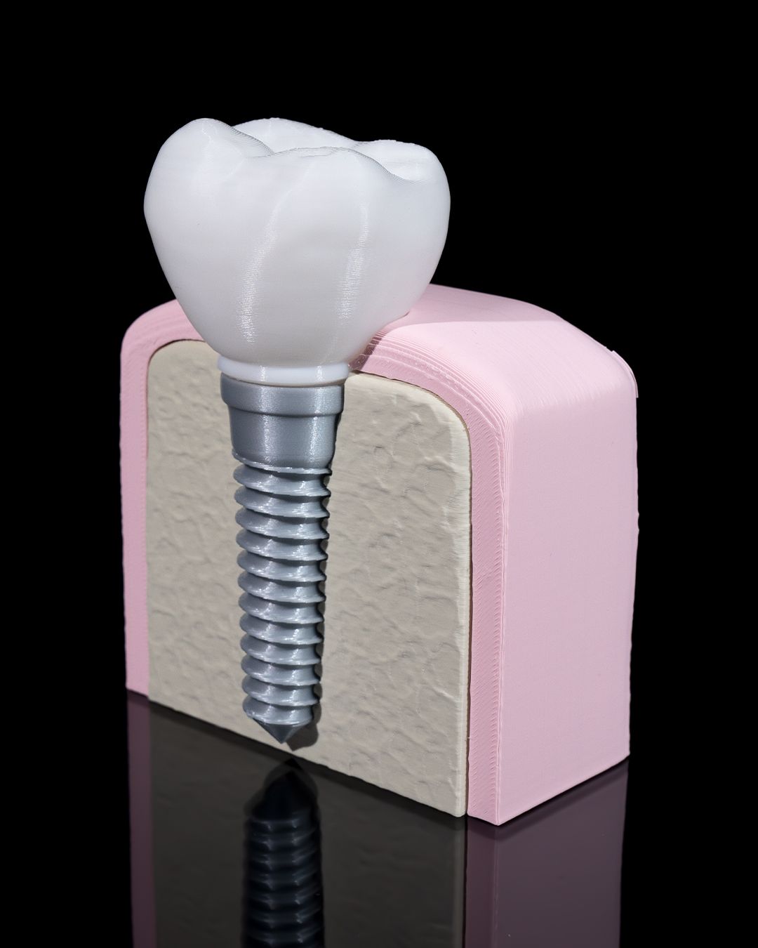 Healthy Premolar Tooth - 3D Printed Dental Replica